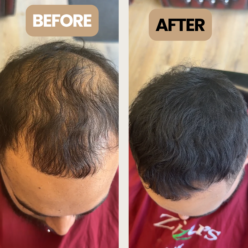 Hair Cover Up Powder For Men Hair Loss - Instant Coverage That Lasts All Day