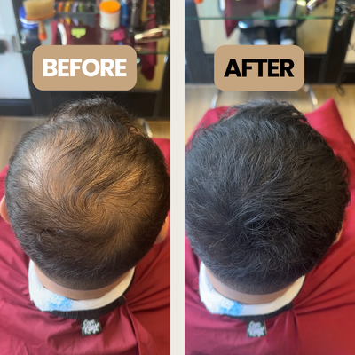 Hair Cover Up Powder For Men Hair Loss - Instant Coverage That Lasts All Day