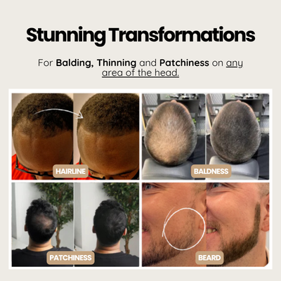 Hair Cover Up Powder For Men Hair Loss - Instant Coverage That Lasts All Day